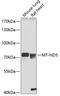 NADH-ubiquinone oxidoreductase chain 5 antibody, 14-438, ProSci, Western Blot image 
