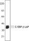 CCAAT Enhancer Binding Protein Beta antibody, LS-C40854, Lifespan Biosciences, Western Blot image 