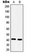 5-Hydroxytryptamine Receptor 4 antibody, LS-C352338, Lifespan Biosciences, Western Blot image 