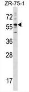 Keratin 3 antibody, AP52417PU-N, Origene, Western Blot image 