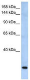 F-Box And WD Repeat Domain Containing 10 antibody, TA340206, Origene, Western Blot image 