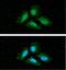 Protein Phosphatase 1 Catalytic Subunit Alpha antibody, GTX57557, GeneTex, Immunocytochemistry image 