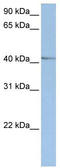 Nuclear Receptor Subfamily 2 Group E Member 1 antibody, TA338238, Origene, Western Blot image 