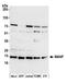 ARP antibody, A305-572A, Bethyl Labs, Western Blot image 