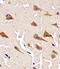 Peptidyl-prolyl cis-trans isomerase D antibody, M02424-1, Boster Biological Technology, Immunohistochemistry paraffin image 