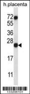 Ribonuclease A Family Member 8 antibody, 57-058, ProSci, Western Blot image 