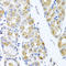 Transmembrane Protein 43 antibody, A05893, Boster Biological Technology, Immunohistochemistry paraffin image 