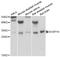 Dual Specificity Phosphatase 19 antibody, STJ27983, St John