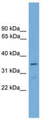 Forkhead box protein I2 antibody, TA331432, Origene, Western Blot image 