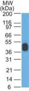 Keratin 1 antibody, NBP2-29411, Novus Biologicals, Western Blot image 