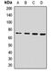 Solute Carrier Family 11 Member 2 antibody, orb411696, Biorbyt, Western Blot image 