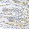 TRNA Methyltransferase 1 antibody, A7116, ABclonal Technology, Immunohistochemistry paraffin image 