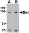 Ski oncogene antibody, TA306035, Origene, Western Blot image 