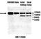 ATP Binding Cassette Subfamily A Member 3 antibody, orb77619, Biorbyt, Western Blot image 