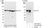 Chaperonin Containing TCP1 Subunit 3 antibody, A303-459A, Bethyl Labs, Immunoprecipitation image 