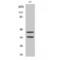 Cyclin Dependent Kinase 10 antibody, LS-C382618, Lifespan Biosciences, Western Blot image 