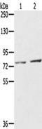 Endothelin-converting enzyme 2 antibody, TA349914, Origene, Western Blot image 