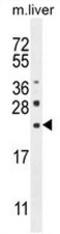 C-Type Lectin Domain Family 2 Member L antibody, AP50961PU-N, Origene, Western Blot image 