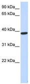 Protein phosphatase 1 regulatory subunit 7 antibody, TA337690, Origene, Western Blot image 