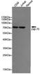 Zeta Chain Of T Cell Receptor Associated Protein Kinase 70 antibody, TA347075, Origene, Western Blot image 