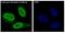 Androgen Receptor antibody, M00542-2, Boster Biological Technology, Immunofluorescence image 