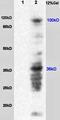 Solute Carrier Family 8 Member A3 antibody, orb11106, Biorbyt, Western Blot image 