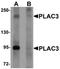Pappalysin-2 antibody, orb75511, Biorbyt, Western Blot image 