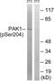 Alpha-PAK antibody, LS-C199398, Lifespan Biosciences, Western Blot image 