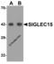 Sialic acid-binding Ig-like lectin 15 antibody, 6765, ProSci Inc, Western Blot image 
