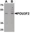 POU Class 3 Homeobox 2 antibody, PA5-34469, Invitrogen Antibodies, Western Blot image 
