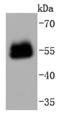 Paired Box 6 antibody, NBP2-67789, Novus Biologicals, Western Blot image 