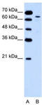 Keratin 2 antibody, TA346190, Origene, Western Blot image 
