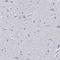 Hemogen antibody, HPA019572, Atlas Antibodies, Immunohistochemistry frozen image 