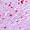 DBF4 Zinc Finger antibody, GTX55192, GeneTex, Immunohistochemistry paraffin image 