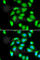 Ribosomal Protein S5 antibody, A6975, ABclonal Technology, Immunofluorescence image 
