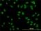 TATA-Box Binding Protein Associated Factor 11 antibody, H00006882-M04, Novus Biologicals, Immunocytochemistry image 