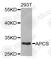 Amyloid P Component, Serum antibody, A1996, ABclonal Technology, Western Blot image 
