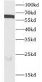 Cell division control protein 6 homolog antibody, FNab01536, FineTest, Western Blot image 