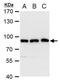 hVPS35 antibody, PA5-21898, Invitrogen Antibodies, Western Blot image 