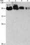 Epidermal Growth Factor Receptor Pathway Substrate 15 Like 1 antibody, PA5-50339, Invitrogen Antibodies, Western Blot image 