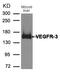 FLT4 antibody, A01276, Boster Biological Technology, Western Blot image 