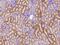 Syntaxin 6 antibody, 106430-T08, Sino Biological, Immunohistochemistry paraffin image 