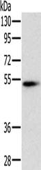 Pancreatic Lipase antibody, CSB-PA132878, Cusabio, Western Blot image 