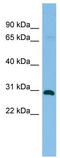 Hematopoietically-expressed homeobox protein HHEX antibody, TA341775, Origene, Western Blot image 