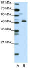 ZPR1 Zinc Finger antibody, TA343430, Origene, Western Blot image 