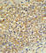 UDP-glucuronosyltransferase 2B17 antibody, abx032833, Abbexa, Western Blot image 