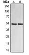 EGF Containing Fibulin Extracellular Matrix Protein 2 antibody, orb215157, Biorbyt, Western Blot image 
