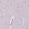 KI-67 antibody, HPA001164, Atlas Antibodies, Immunohistochemistry frozen image 