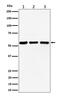 Pre-MRNA Processing Factor 4 antibody, M08225-1, Boster Biological Technology, Western Blot image 