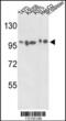 Actinin Alpha 4 antibody, 63-207, ProSci, Western Blot image 